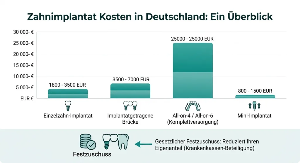 Kostenübersicht Zahnimplantate mit Festzuschuss-Information